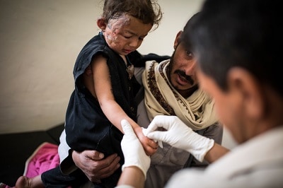 The nurse changing the dressing of this little girl who fell down in a fire and had burns at a foot and on the face.